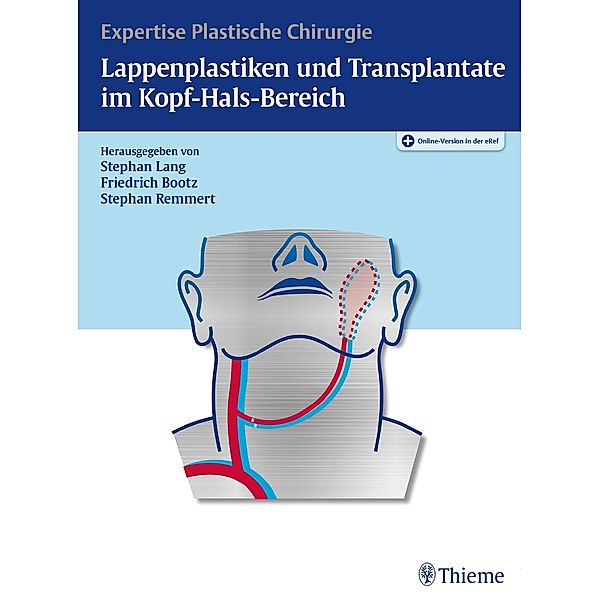 Lappenplastiken und Transplantate im Kopf-Hals-Bereich