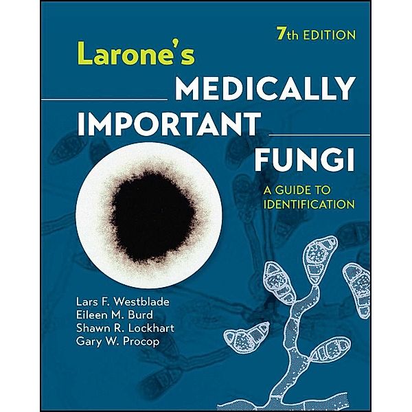 Larone's Medically Important Fungi, Lars F. Westblade, Eileen M. Burd, Shawn R. Lockhart, Gary W. Procop