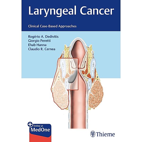 Laryngeal Cancer, Rogério A. Dedivitis, Giorgio Peretti, Claudio R. Cernea