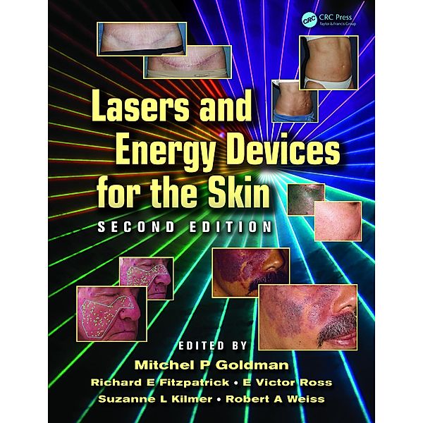 Lasers and Energy Devices for the Skin