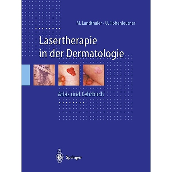 Lasertherapie in der Dermatologie, Michael Landthaler, Ulrich Hohenleutner