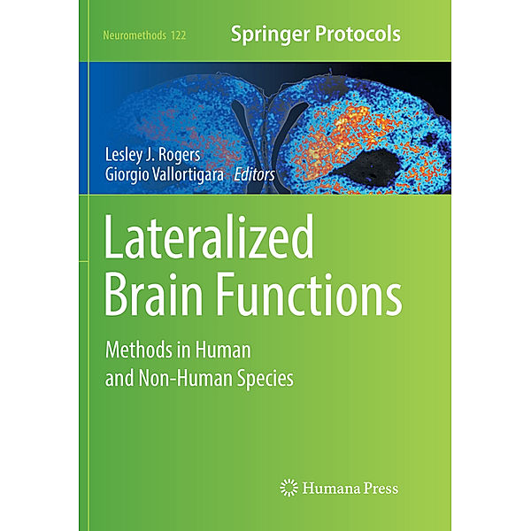 Lateralized Brain Functions