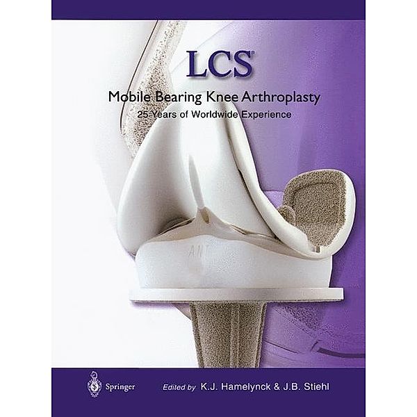 LCS® Mobile Bearing Knee Arthroplasty