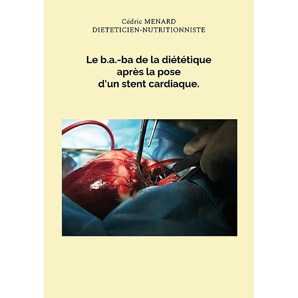 Le b.a.-ba de la diététique après la pose d'un stent cardiaque. / Savoir quoi manger tout simplement... Bd.-, Cédric Menard