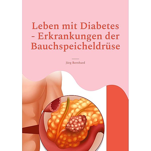 Leben mit Diabetes - Erkrankungen der Bauchspeicheldrüse, Jörg Bernhard