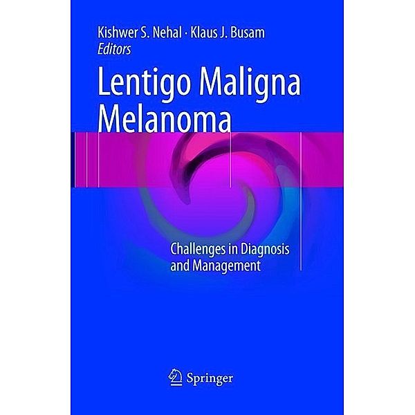 Lentigo Maligna Melanoma