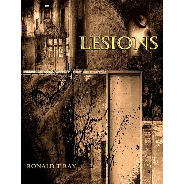 Lesions, Ronald T Ray