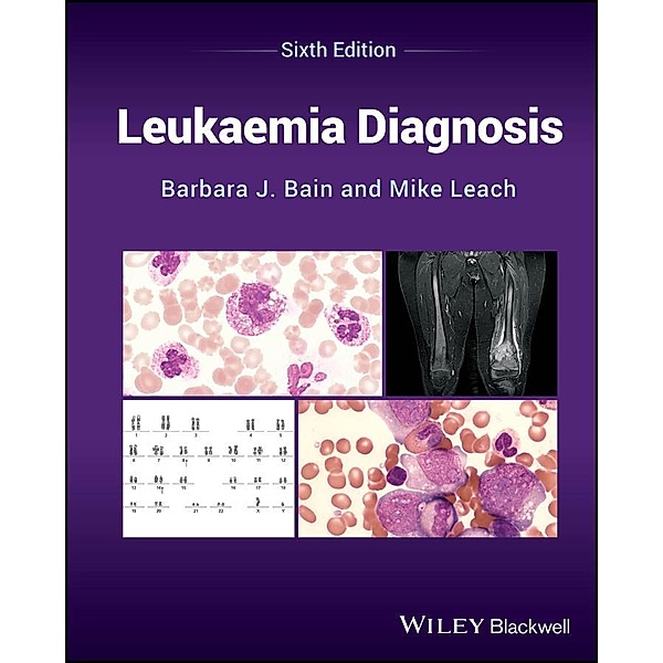 Leukaemia Diagnosis, Barbara J. Bain, Mike Leach