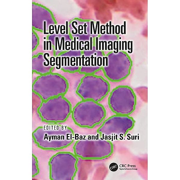 Level Set Method in Medical Imaging Segmentation