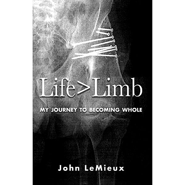 Life is Greater Than Limb, John LeMieux