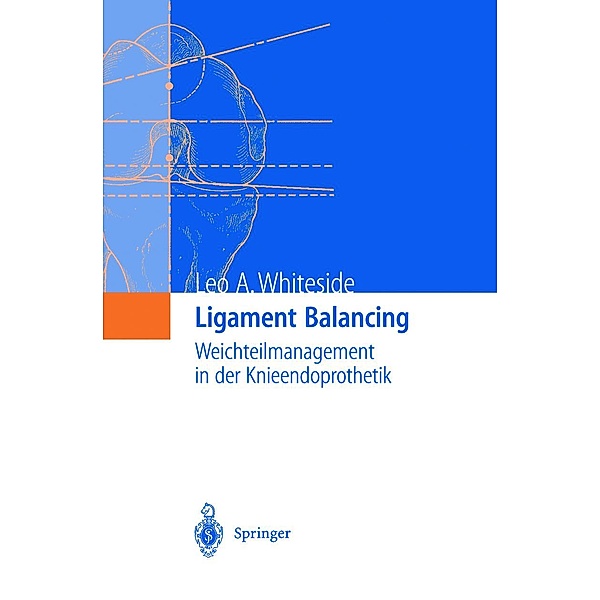 Ligament Balancing, Leo A. Whiteside