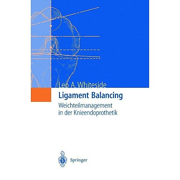 Ligament Balancing, Leo A. Whiteside