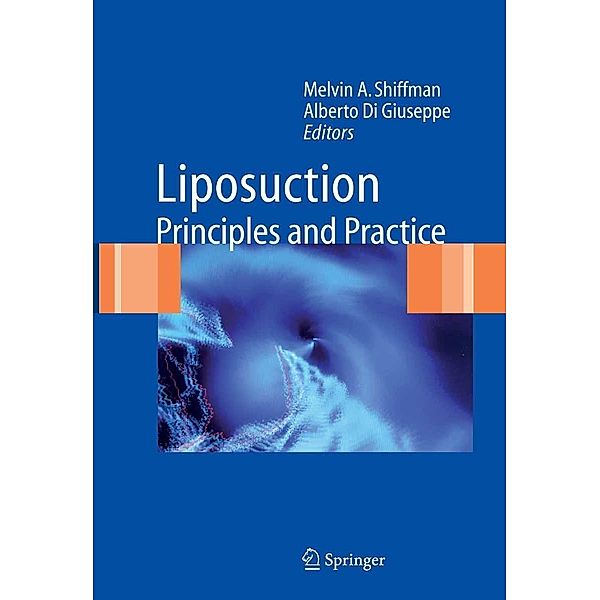 Liposuction, Alberto DiGiuseppe, Melvin A. Shiffman