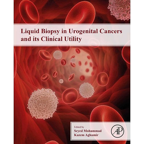 Liquid Biopsy in Urogenital Cancers and its Clinical Utility