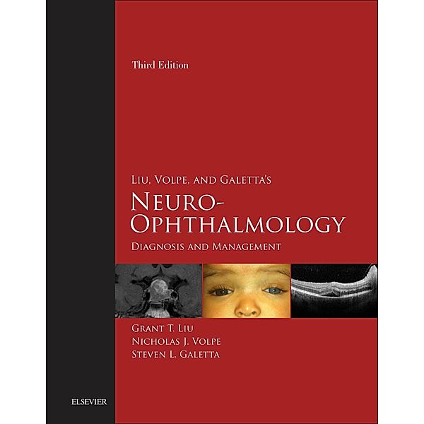 Liu, Volpe, and Galetta's Neuro-Ophthalmology E-Book, Grant T. Liu, Nicholas J. Volpe, Steven L. Galetta