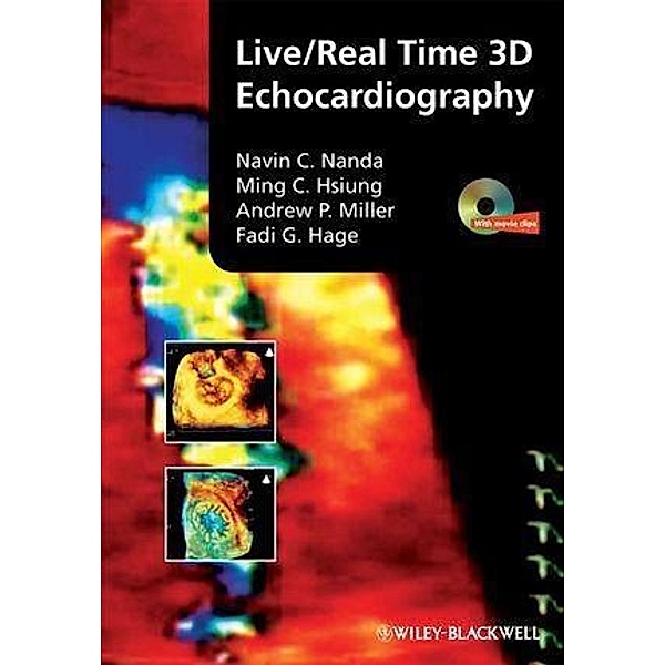 Live/Real Time 3D Echocardiography, Navin Nanda, Ming Chon Hsiung, Andrew P. Miller, Fadi G. Hage
