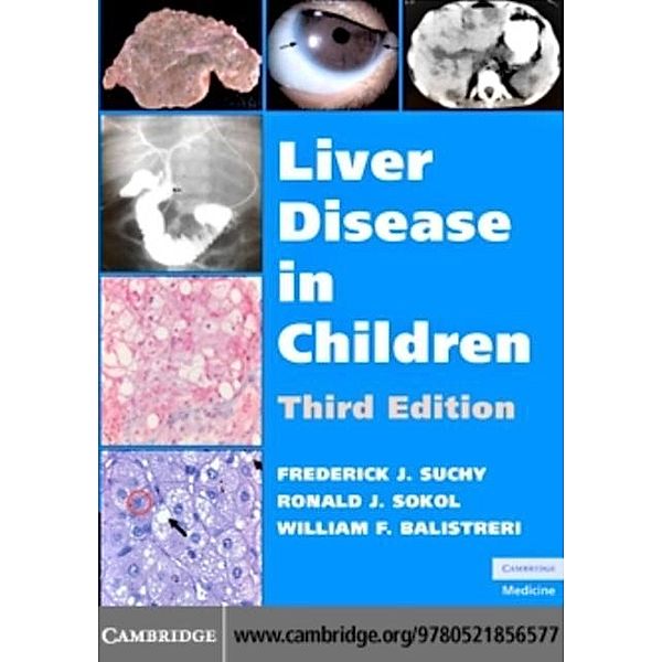 Liver Disease in Children