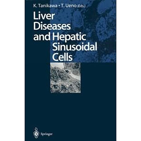 Liver Diseases and Hepatic Sinusoidal Cells