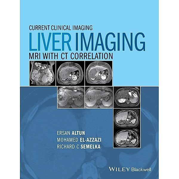 Liver Imaging / Current Clinical Imaging