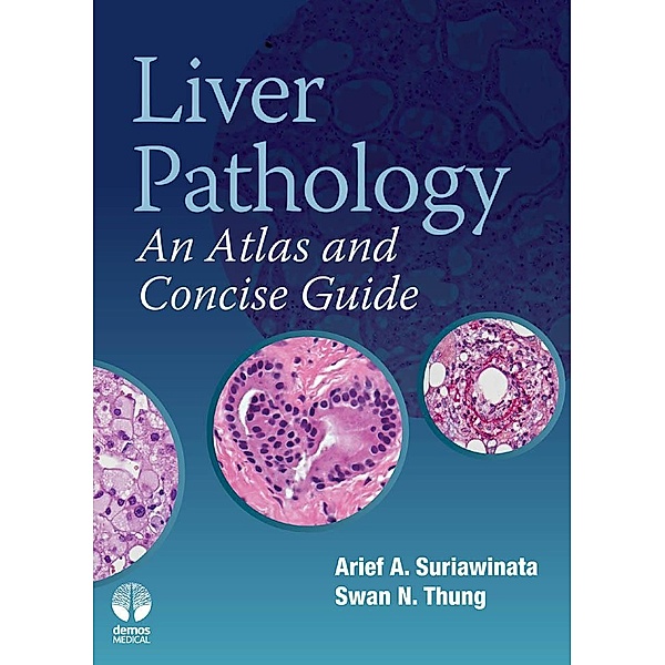 Liver Pathology, Arief A Suriawinata, Swan N. Thung