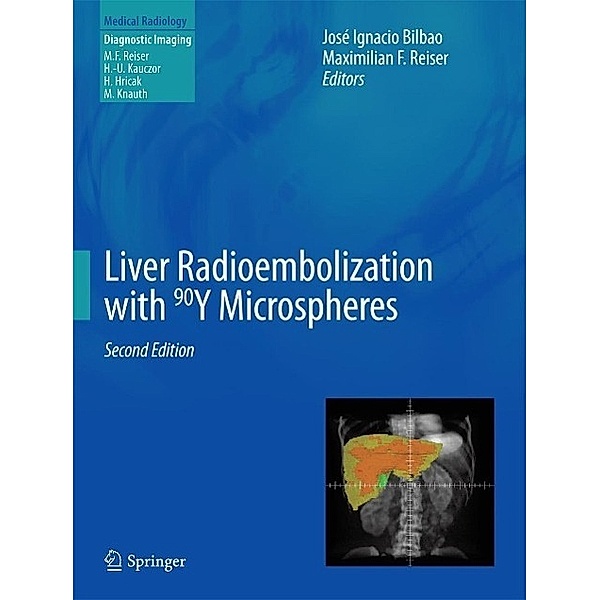 Liver Radioembolization with 90Y Microspheres / Medical Radiology
