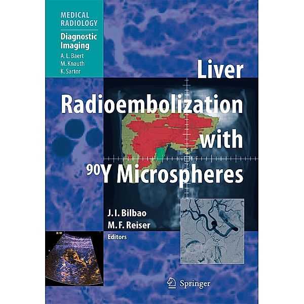 Liver Radioembolization with 90Y Microspheres / Medical Radiology