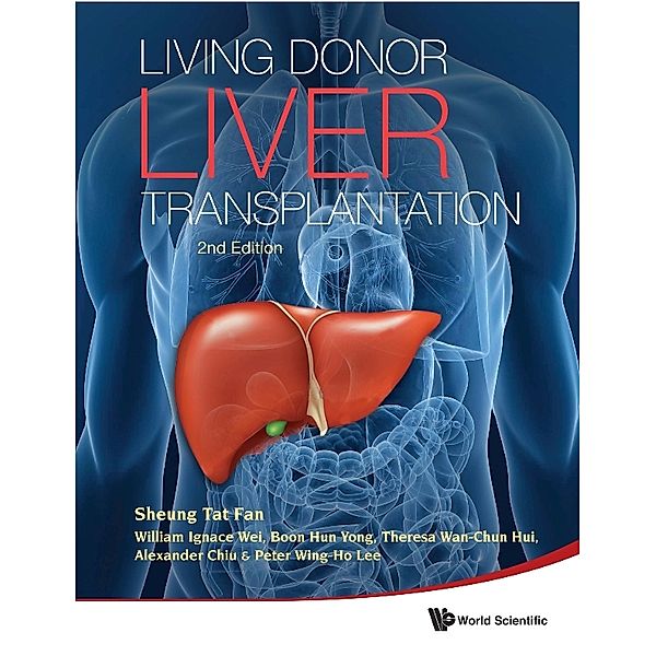 Living Donor Liver Transplantation (2nd Edition), Alexander Chiu, Sheung Tat Fan, Theresa Wan-chun Hui