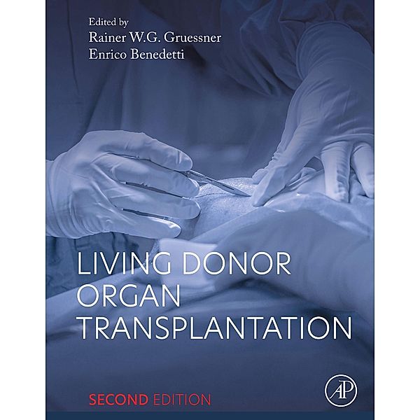 Living Donor Organ Transplantation