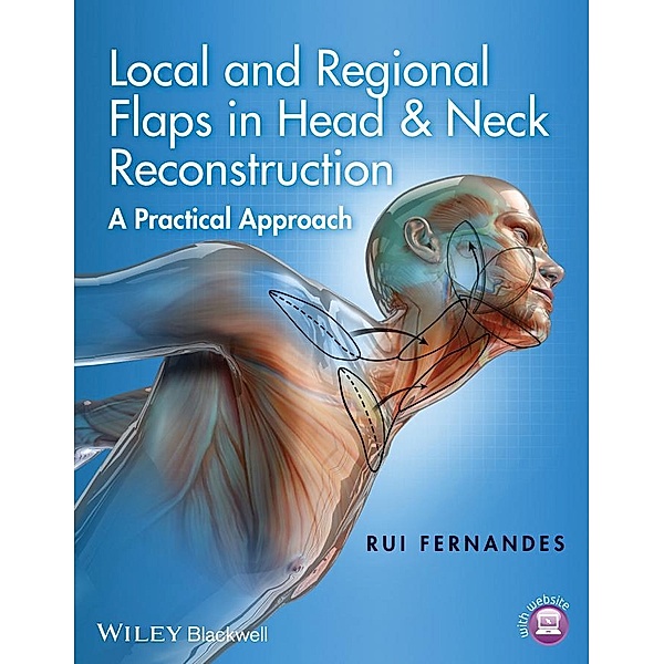 Local and Regional Flaps in Head and Neck Reconstruction, Rui Fernandes