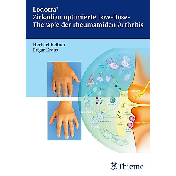 Lodotra - Zirkadian optimierte Low-Dose-Therapie der rheumatoiden Arthritis, Herbert Kellner, Edgar Kraus