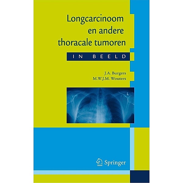 Longcarcinoom en andere thoracale tumoren in beeld, J. A. Burgers, M. Wouters