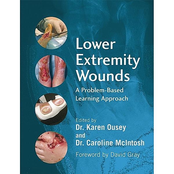 Lower Extremity Wounds