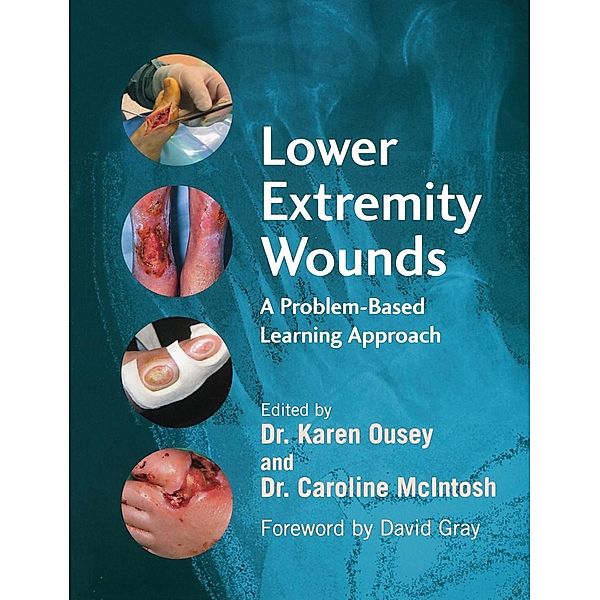 Lower Extremity Wounds