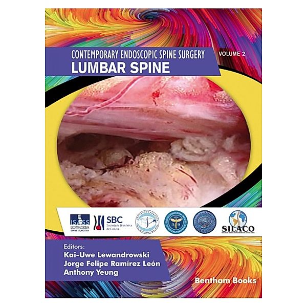 Lumbar Spine / Contemporary Endoscopic Spine Surgery Bd.2