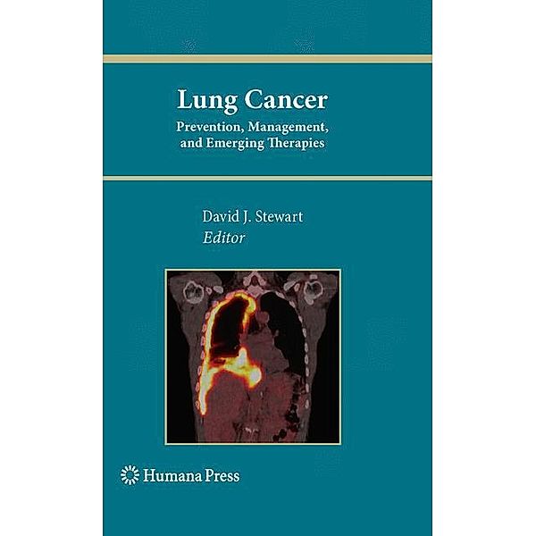 Lung Cancer: