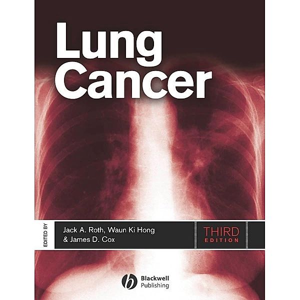 Lung Cancer