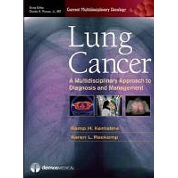 Lung Cancer: A Multidisciplinary Approach to Diagnosis and Management, Kemp Kernstine, Karen Reckamp, Charles Thomas