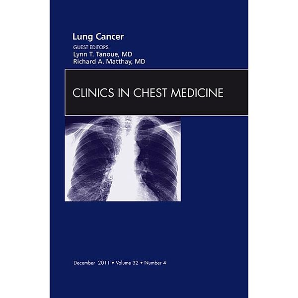 Lung Cancer, An Issue of Clinics in Chest Medicine, Lynn T. Tanoue, Richard A. Matthay