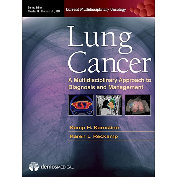 Lung Cancer / Current Multidisciplinary Oncology