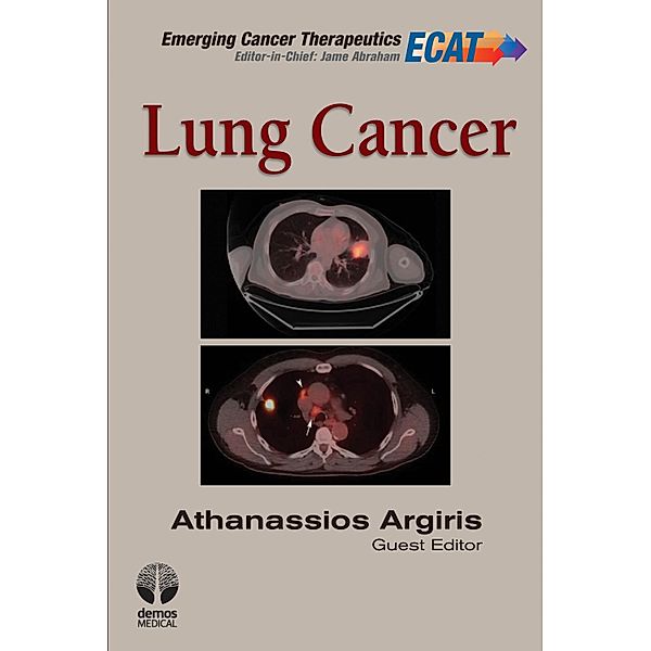 Lung Cancer / Emerging Cancer Therapeutics Bd.Volume 3, Issue 1