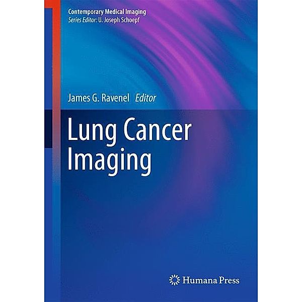 Lung Cancer Imaging