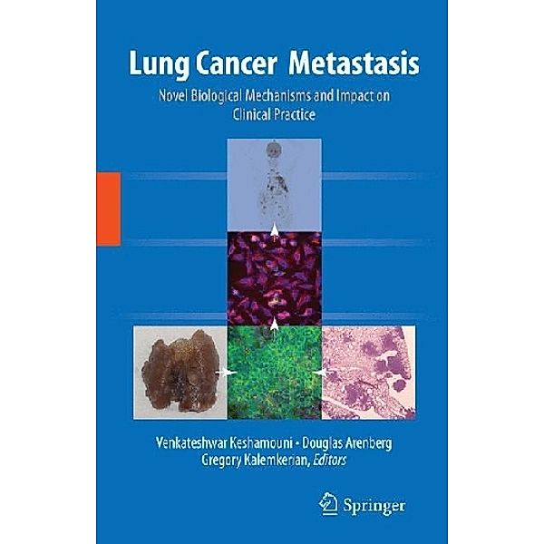 Lung Cancer Metastasis