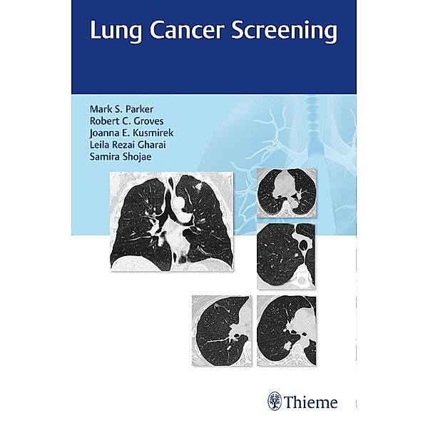 Lung Cancer Screening, Mark Parker, Robert Groves, Joanna Kusmirek, Leila Rezai Gharai, Samira Shojaee