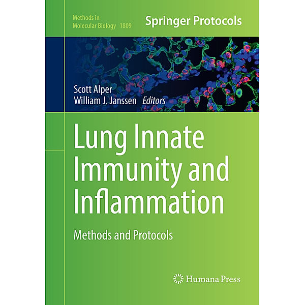 Lung Innate Immunity and Inflammation