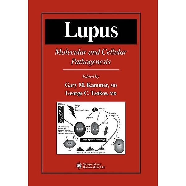 Lupus / Contemporary Immunology