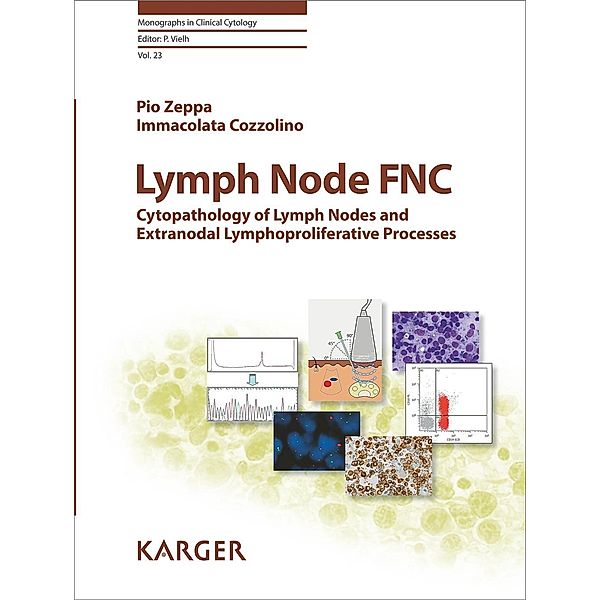 Lymph Node FNC, P. Zeppa, I. Cozzolino