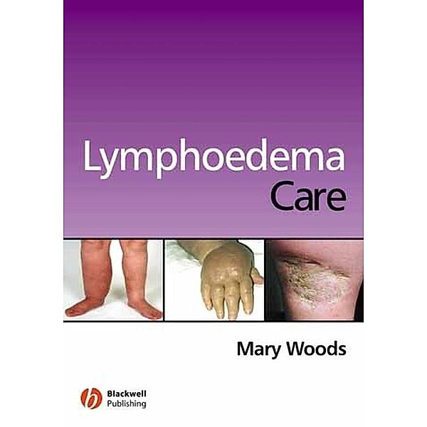 Lymphoedema Care, Mary Elizabeth Woods