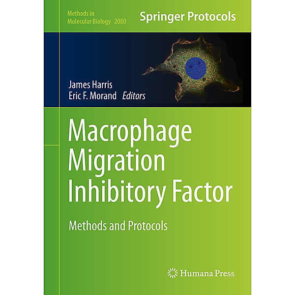 Macrophage Migration Inhibitory Factor