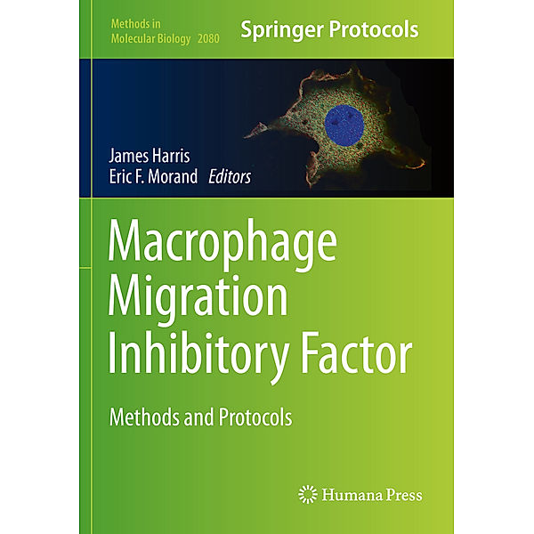 Macrophage Migration Inhibitory Factor