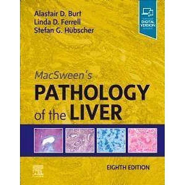 MacSween's Pathology of the Liver, Alastair D. Burt, Linda D. Ferrell, Stefan G. Hübscher
